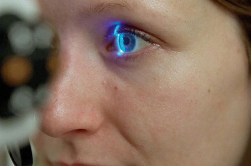 Ученым удалось выяснить, как восстановить зрение при глаукоме
